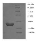 SDS-PAGE