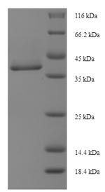 SDS-PAGE