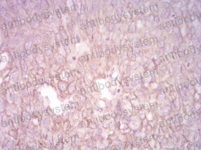 Валидация AntibodySystem RHC99501