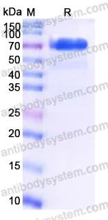 EHK22901, SDS-PAGE