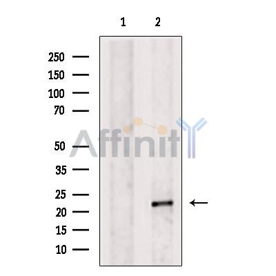 Валидация Affinity DF2546 - 13209