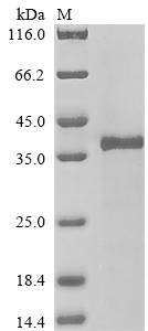 SDS-PAGE