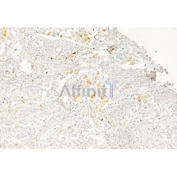 Валидация Affinity AF6197 - 3425