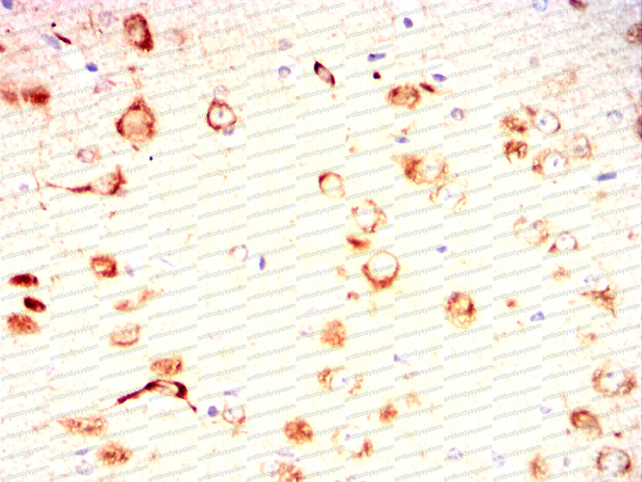 Валидация AntibodySystem RHG72104 (3065)