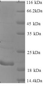 SDS-PAGE