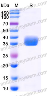AHJ70102, SDS-PAGE