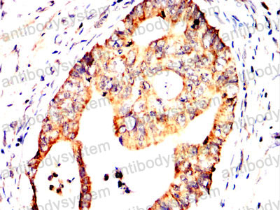 Валидация AntibodySystem RHK06402