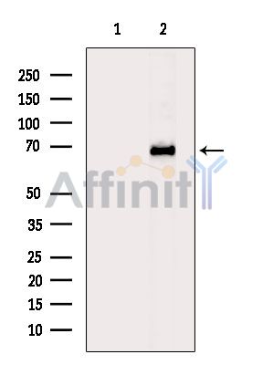 Валидация Affinity DF14572 - 10574
