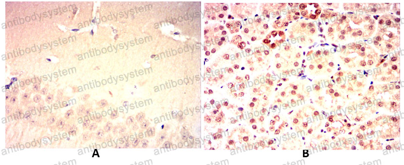 Валидация AntibodySystem RHD79503