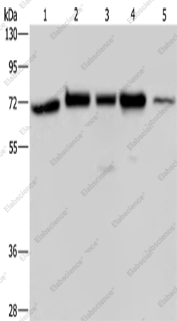 Вестерн-блоттинг, AGFG1, клетки A172, HeLa, 293T, K562 и ткань яичка человека