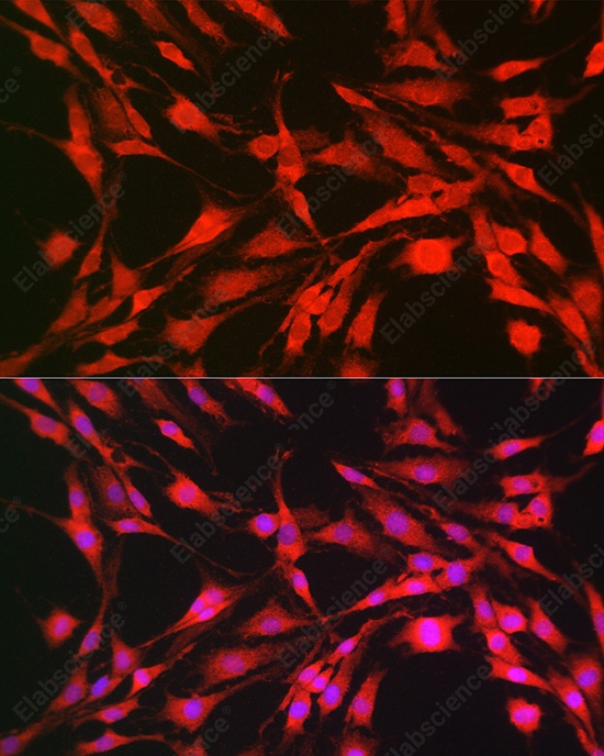 Иммунофлуоресценция, p70 S6 Kinase 1, клетки C6