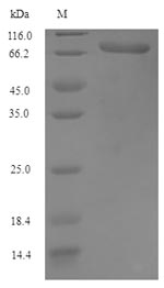 SDS-PAGE