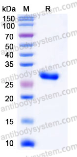 YHE25902, SDS-PAGE