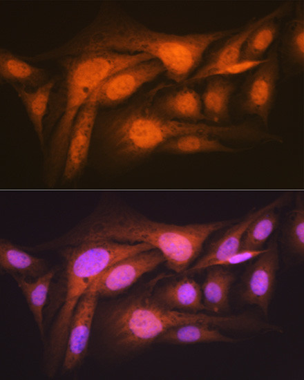 Валидация AssayVector ARM1593(1656)