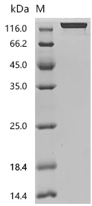 SDS-PAGE