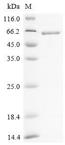 SDS-PAGE