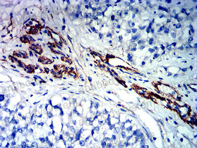 Валидация AntibodySystem RHF87802
