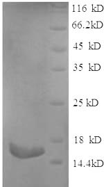 SDS-PAGE