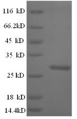 SDS-PAGE