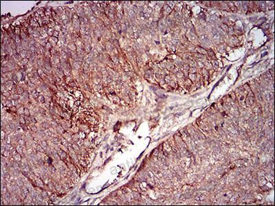 Валидация AntibodySystem RMN92903 (4195)
