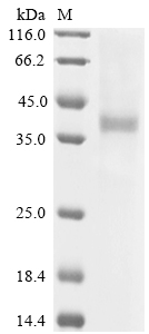 SDS-PAGE