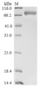 SDS-PAGE