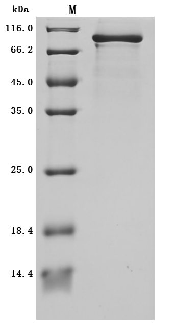 SDS-PAGE
