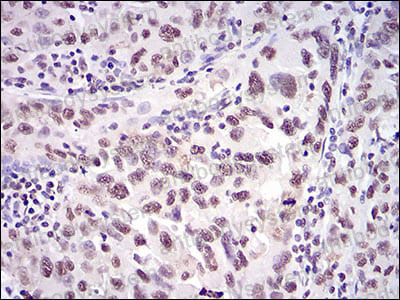 Валидация AntibodySystem RHC95903 (1214)