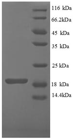 SDS-PAGE