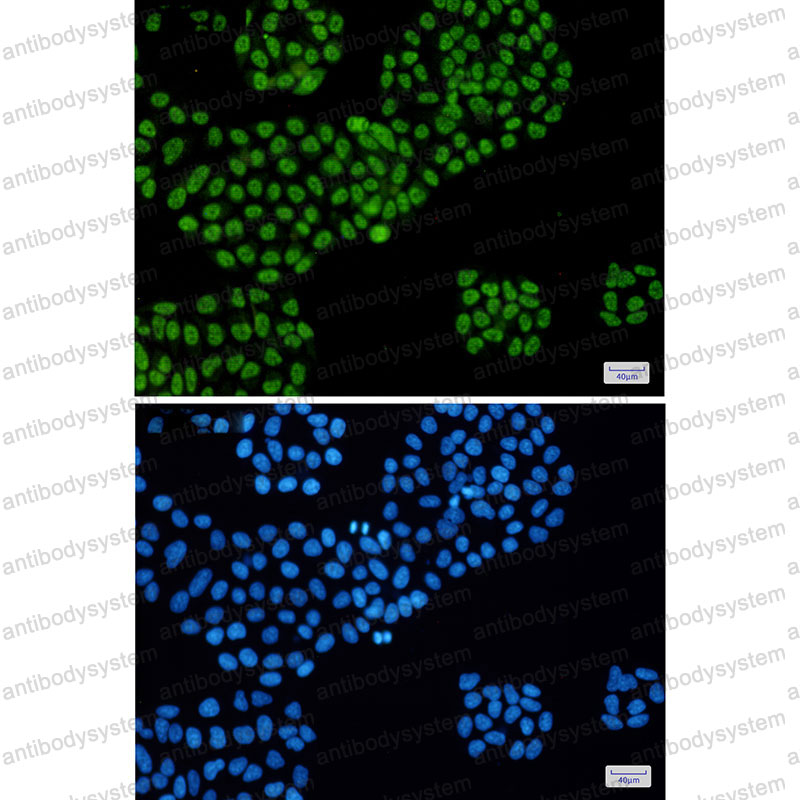 Валидация IF - AntibodySystem RHD26601