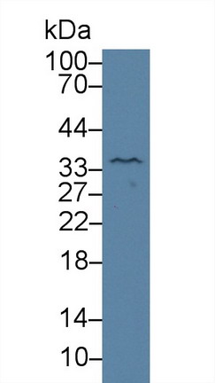10155
