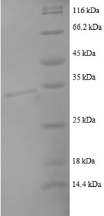 SDS-PAGE