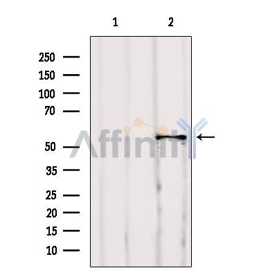 Валидация Affinity AF6261 - 3511