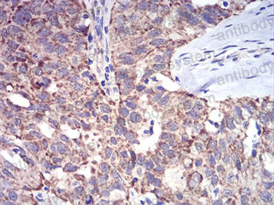 Валидация AntibodySystem RHF92801 (2730)