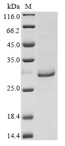 SDS-PAGE