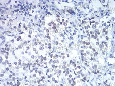 Валидация AntibodySystem RHD26602