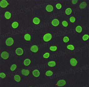 Валидация IF - AntibodySystem RHB98204