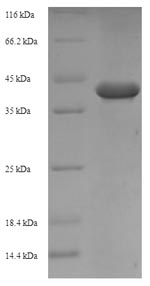 SDS-PAGE