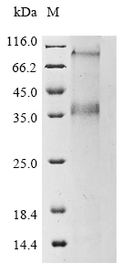SDS-PAGE