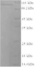 SDS-PAGE