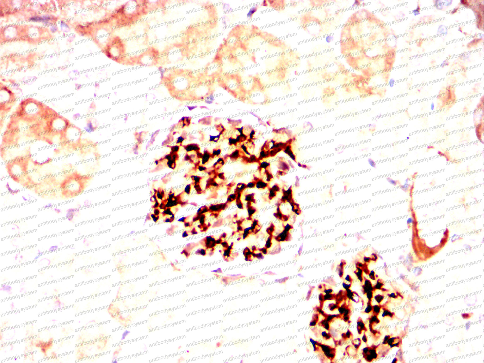 Валидация AntibodySystem RHC07802