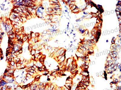 Валидация AntibodySystem RHD23003