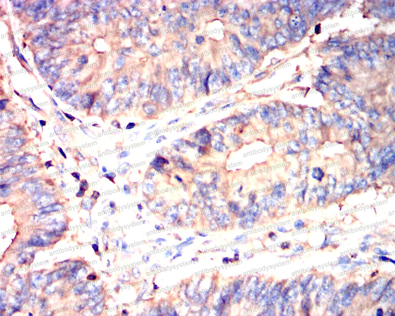 Валидация AntibodySystem RHE35201 (2098)