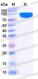 EHD12301, SDS-PAGE