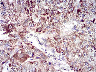 Валидация AntibodySystem RHA19002 (55)