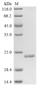 SDS-PAGE