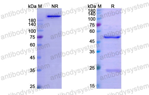Валидация SDS-PAGE - AntibodySystem DHJ14801