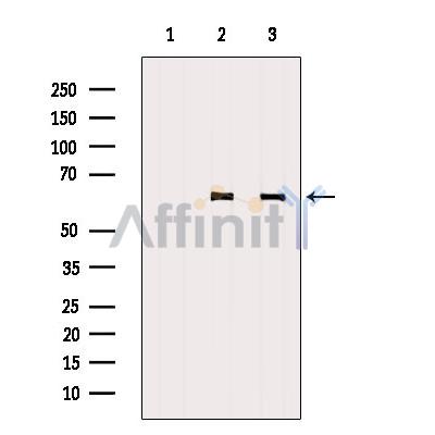 Валидация Affinity DF3020 - 13754