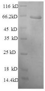 SDS-PAGE