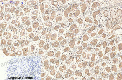 Валидация AntibodySystem RHD36801 (1524)